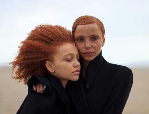 Albinism and Rufous Albinism in Black People