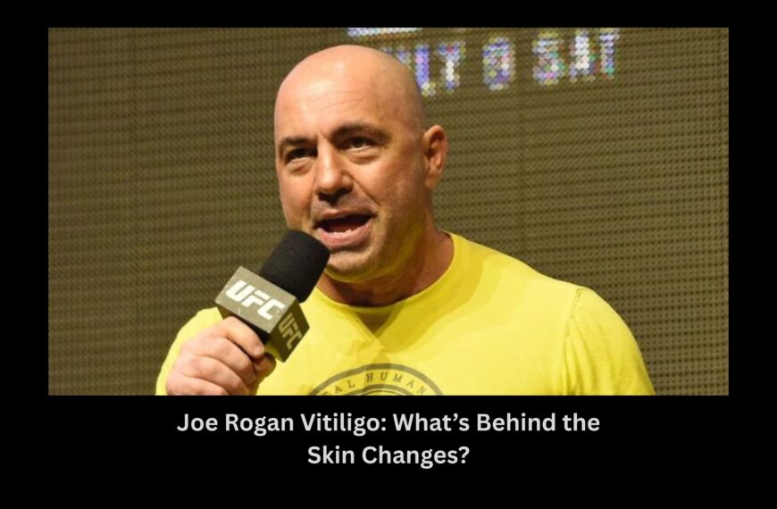 Joe Rogan Vitiligo: What’s Behind the Skin Changes?
