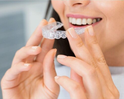 Teeth shifting