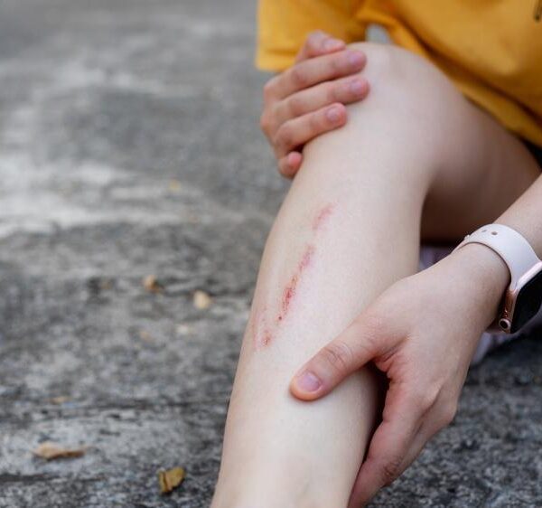 7 Key Steps in a Pedestrian Injury Compensation Claim