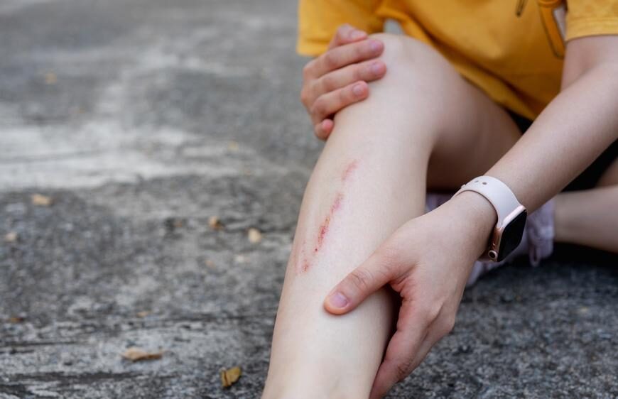 7 Key Steps in a Pedestrian Injury Compensation Claim